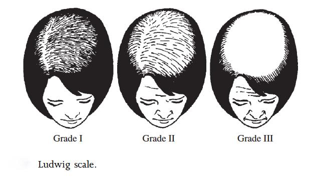 1448592871129055.jpg hair.jpg