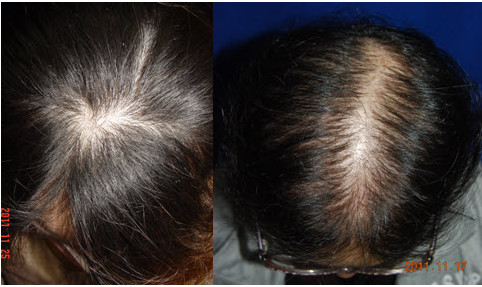 1448605021224293.jpg snap0336.jpg