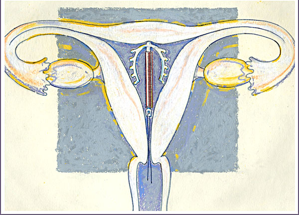 子宮肌瘤有什么癥狀嗎 自然醫(yī)學治療促排毒 子宮肌瘤有什么癥狀嗎 自然醫(yī)學治療促排毒