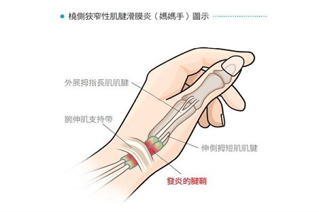 媽媽手檢測(cè) 媽媽手檢測(cè)