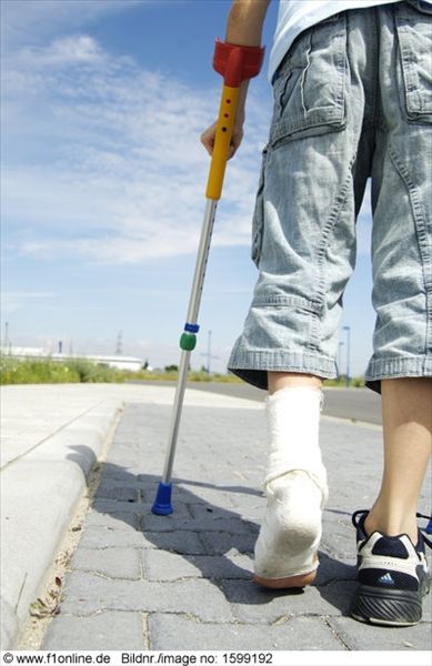 腿骨折后怎樣恢復(fù)得快 腿骨折后怎樣恢復(fù)得快