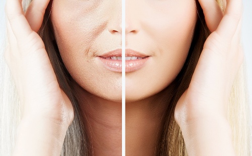 化妝后法令紋更明顯應(yīng)該怎么辦 化妝后法令紋更明顯應(yīng)該怎么辦