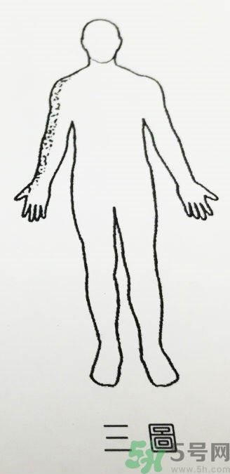 經(jīng)常手麻腳麻是怎么回事 4種疾病的前兆 經(jīng)常手麻腳麻是怎么回事 4種疾病的前兆