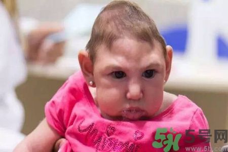 塞卡病毒診斷治療預防一體化療程 塞卡病毒診斷治療預防一體化療程