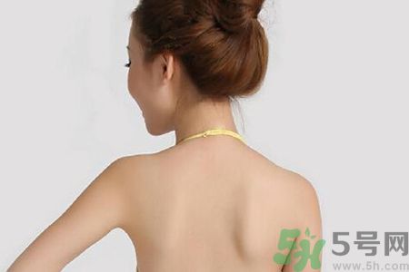 脖子后面長痘痘是什么原因?脖子后面長痘痘怎么治療 脖子后面長痘痘是什么原因?脖子后面長痘痘怎么治療