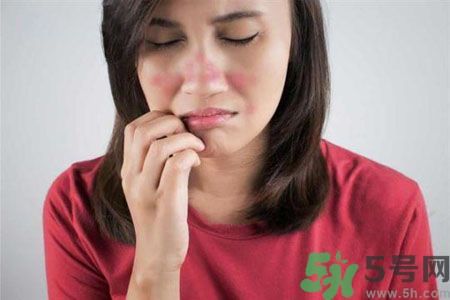 皮膚又紅又癢怎么辦？酒糟皮膚怎么治？