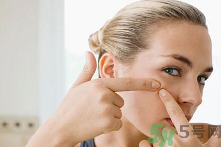 牙膏可以祛痘嗎？牙膏可以祛黑頭嗎？