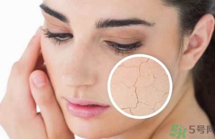 皮膚起皮怎么辦？皮膚起皮用什么護(hù)膚品？