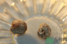 哪些因素容易引發(fā)結(jié)石?怎么有效預(yù)防結(jié)石病?.png 哪些因素容易引發(fā)結(jié)石?怎么有效預(yù)防結(jié)石病?.png