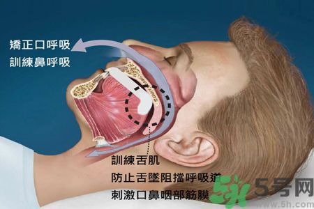 耳鳴是什么原因引起的？耳鳴怎么治療最好？