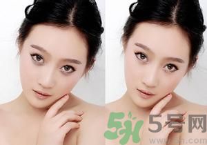 我的黑眼圈為什么是咖啡色的？怎么去除咖啡色黑眼圈？