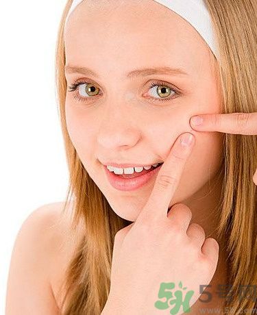 臉上有痘印怎么去除？去除痘印的小妙方？