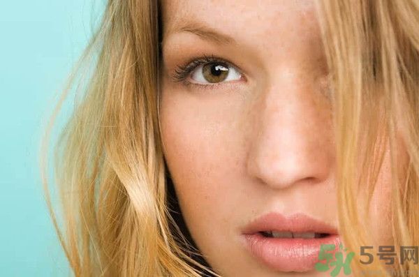 臉上有斑怎么去除？祛斑的小偏方有哪些？