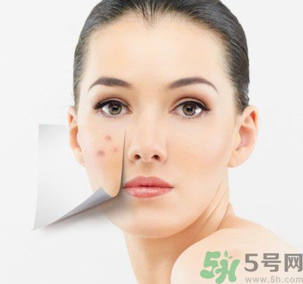 臉上有斑怎么去除？祛斑的小偏方有哪些？