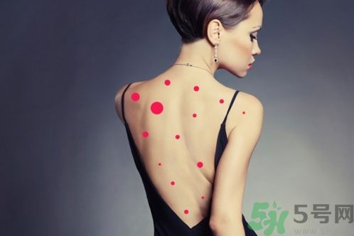 背上為什么會長痘痘？長痘痘怎么辦？