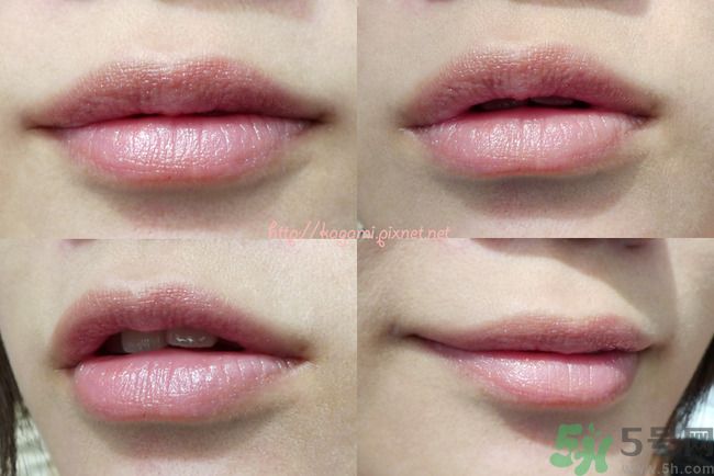 唇色發(fā)白是怎么回事？唇色發(fā)白怎么辦？