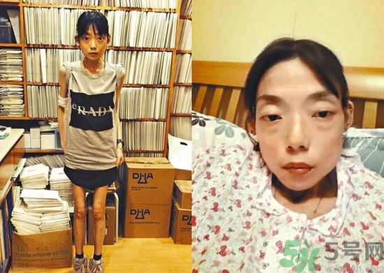 富二代離婚娶二線女星前妻瘦成骷髏  怎么選擇有責(zé)任的男人？