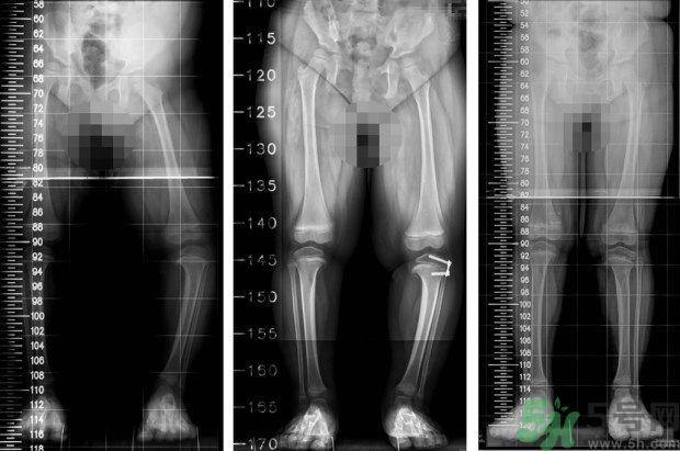 1461115011424592.jpg e98f2e55f318476ea201fe6e23947f21_620.jpg