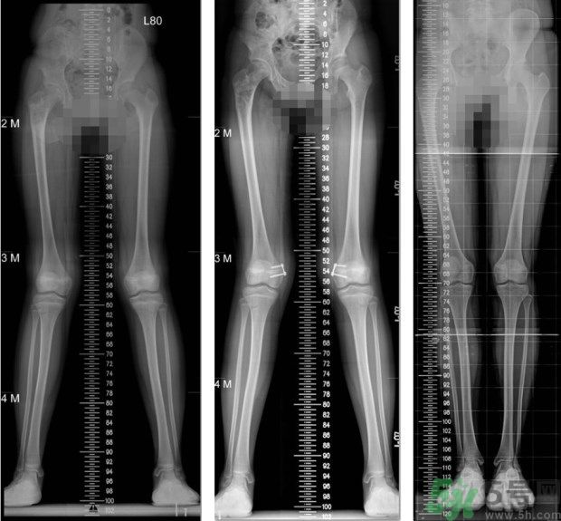 1461115017739436.jpg 7e82c8e4a1eb4e708ee0ce001e363368_620.jpg