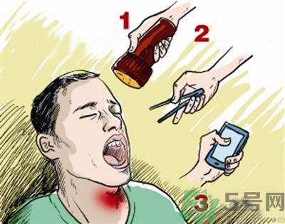 魚刺卡喉喝醋可以治療嗎？魚刺卡喉喝醋好不好？