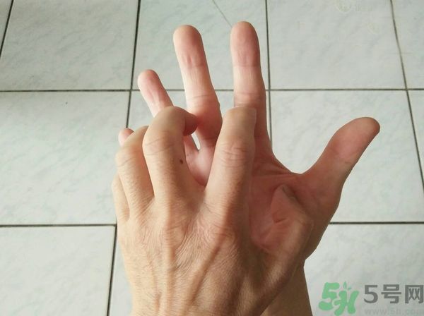 手上起水泡是什么原因？怎樣預(yù)防手上起水泡？