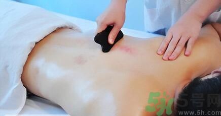 夏季刮痧好嗎？刮痧能治療什么疾??？