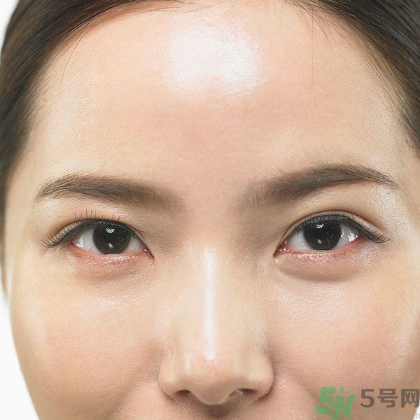 眉周紋是怎么形成的？眉周紋怎么去除？