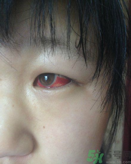 初中生全體甲醛中毒是怎么回事？初中生全體甲醛中毒是哪個學(xué)校？