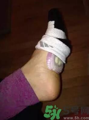 發(fā)燒可以吃洋蔥嗎？發(fā)燒能吃洋蔥嗎？