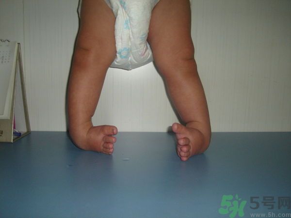 女生3天花8萬是怎么回事？馬蹄足是什么?。? width=