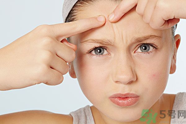 蒲公英可以祛痘嗎？蒲公英怎樣可以祛痘？