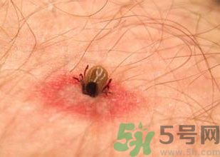 蜱蟲(chóng)到底是什么?蜱蟲(chóng)是什么蟲(chóng)?