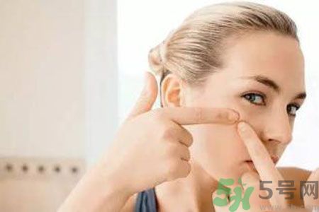 一到夏天呢長(zhǎng)痘痘怎么回事？夏天長(zhǎng)痘痘怎么辦？