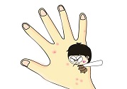 蚊子叮的包過幾天又癢是為什么？蚊子叮的包過幾天又癢怎么辦？