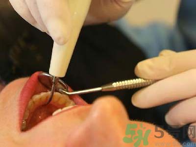 經期可以拔牙嗎?經期拔牙有什么危害 經期可以拔牙嗎?經期拔牙有什么危害