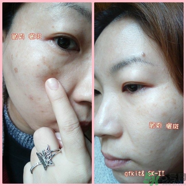 sk2祛斑精華怎么樣？skii祛斑精華使用方法
