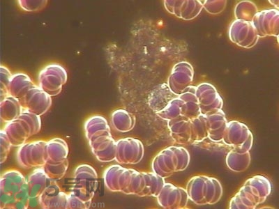 葡萄胎清宮后hcg多久能恢復(fù)正常?葡萄胎清宮后注意事項 葡萄胎清宮后hcg多久能恢復(fù)正常?葡萄胎清宮后注意事項