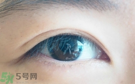單眼皮怎么變雙眼皮了？單眼皮上面有一條線
