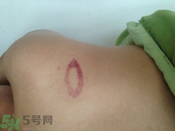 種草莓吻痕是什么意思？吻痕是怎么弄出來的？