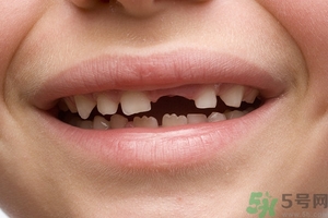 青少年牙齒松動怎么辦？青少年怎么保護牙齒？