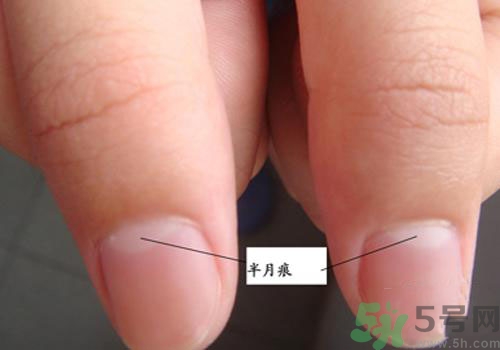指甲沒有月牙是什么原因？指甲沒有月牙怎么調(diào)理？