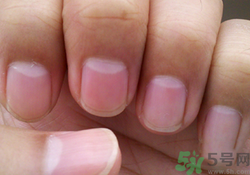 指甲沒有月牙是什么原因？指甲沒有月牙怎么調(diào)理？