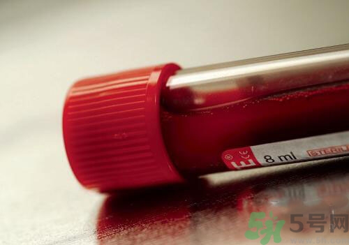 獻(xiàn)血后可以洗澡嗎？抽血后可以洗澡嗎？