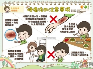 手被油燙傷了怎么處理？手被油燙起泡了怎么辦？