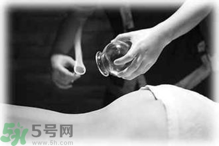 大暑可以拔罐嗎？大暑拔罐好不好？