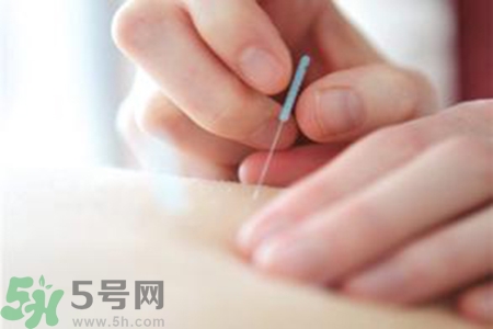 大暑可以針灸嗎？大暑針灸好不好？