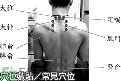 經(jīng)期可以貼三伏貼嗎？來(lái)月經(jīng)可以貼三伏貼嗎？