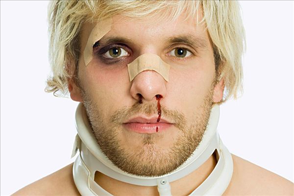 天氣太熱會流鼻血嗎？天氣太熱流鼻血是什么原因？