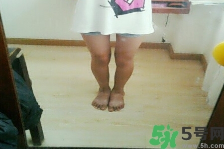 腿曬黑了怎么白回來(lái)？腿曬黑了怎么辦？