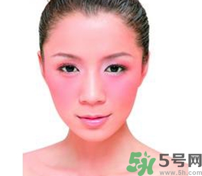 敏感性皮膚用什么洗面奶？敏感性皮膚怎么修復(fù)？